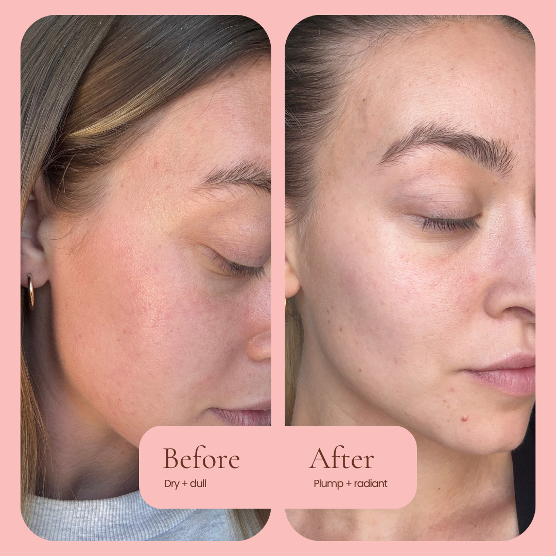 Before and after skincare comparison of a woman's face, showing dry, dull skin on the left and plump, radiant skin on the right, framed by a pink border with text labels. Hub For Belle award winning Antioxidant Hydration Infused Concentrated Face Cream 