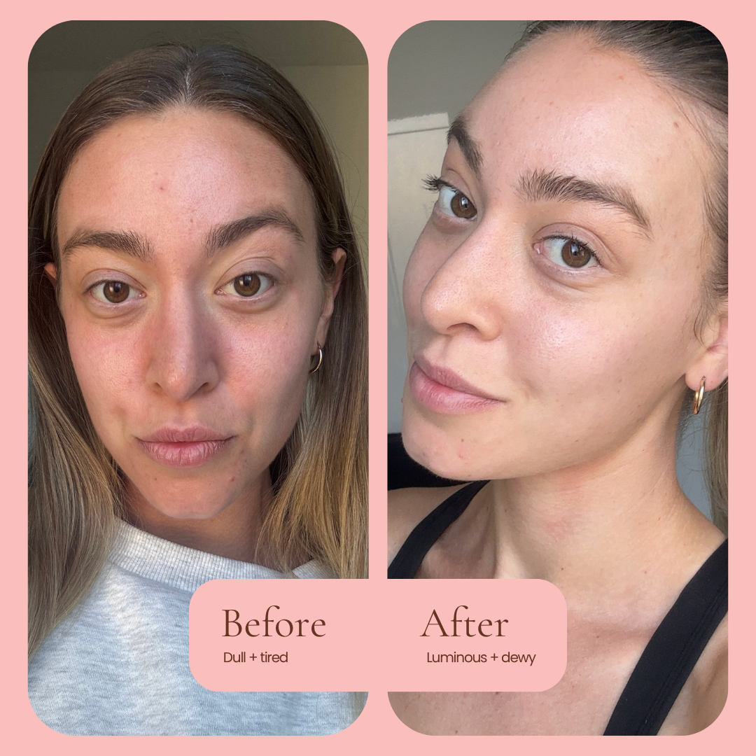Before and after skincare comparison of a woman's face, showing a dull, tired complexion on the left and a luminous, dewy complexion on the right, set against a pink background with text labels. HUB FOR BELLE award winning natural skincare Hydra Glow Facial Oil before and after