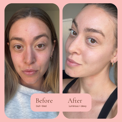 Before and after skincare comparison of a woman's face, showing a dull, tired complexion on the left and a luminous, dewy complexion on the right, set against a pink background with text labels. HUB FOR BELLE award winning natural skincare Hydra Glow Facial Oil before and after