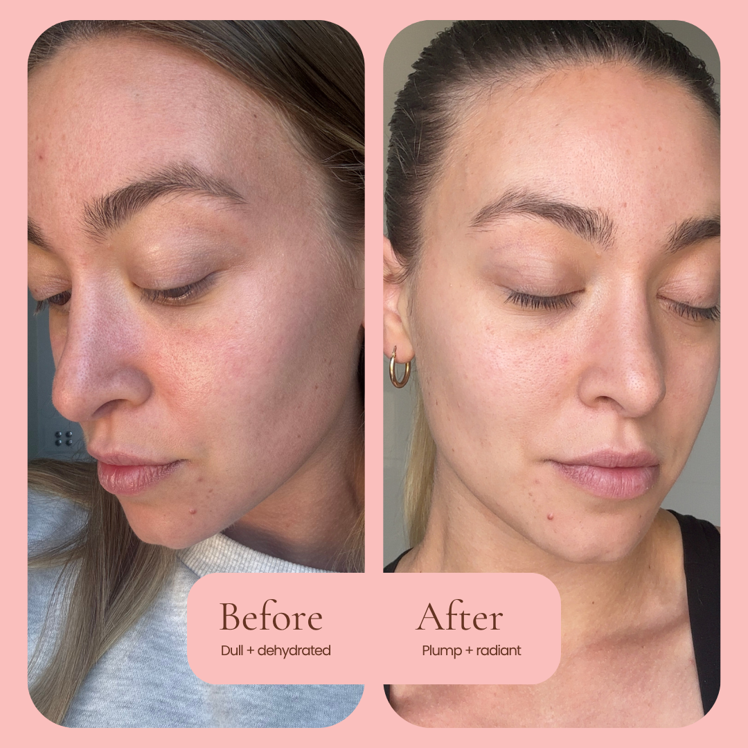 A Hub For Belle award winning natural Hydrating Primer serum Before and after skincare comparison of a woman's face, showing dry, dull skin on the left and hydrated, plump skin on the right, set against a pink background with text labels.