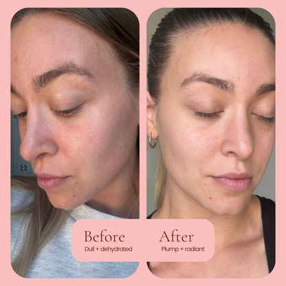 A Hub For Belle award winning natural Hydrating Primer serum Before and after skincare comparison of a woman's face, showing dry, dull skin on the left and hydrated, plump skin on the right, set against a pink background with text labels.