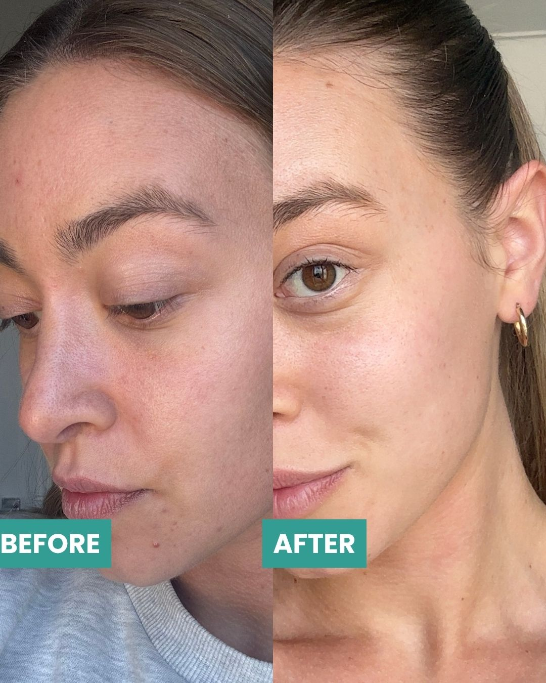 Before and after close-up comparison of a woman's face, showing skincare or makeup results. The left side is labeled 'BEFORE' and shows a more textured, natural complexion.