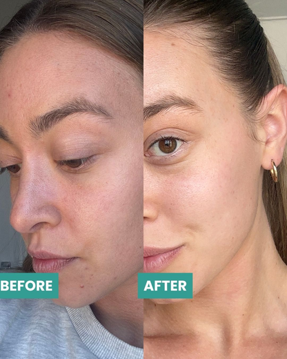 Before and after close-up comparison of a woman's face, showing skincare or makeup results. The left side is labeled 'BEFORE' and shows a more textured, natural complexion.